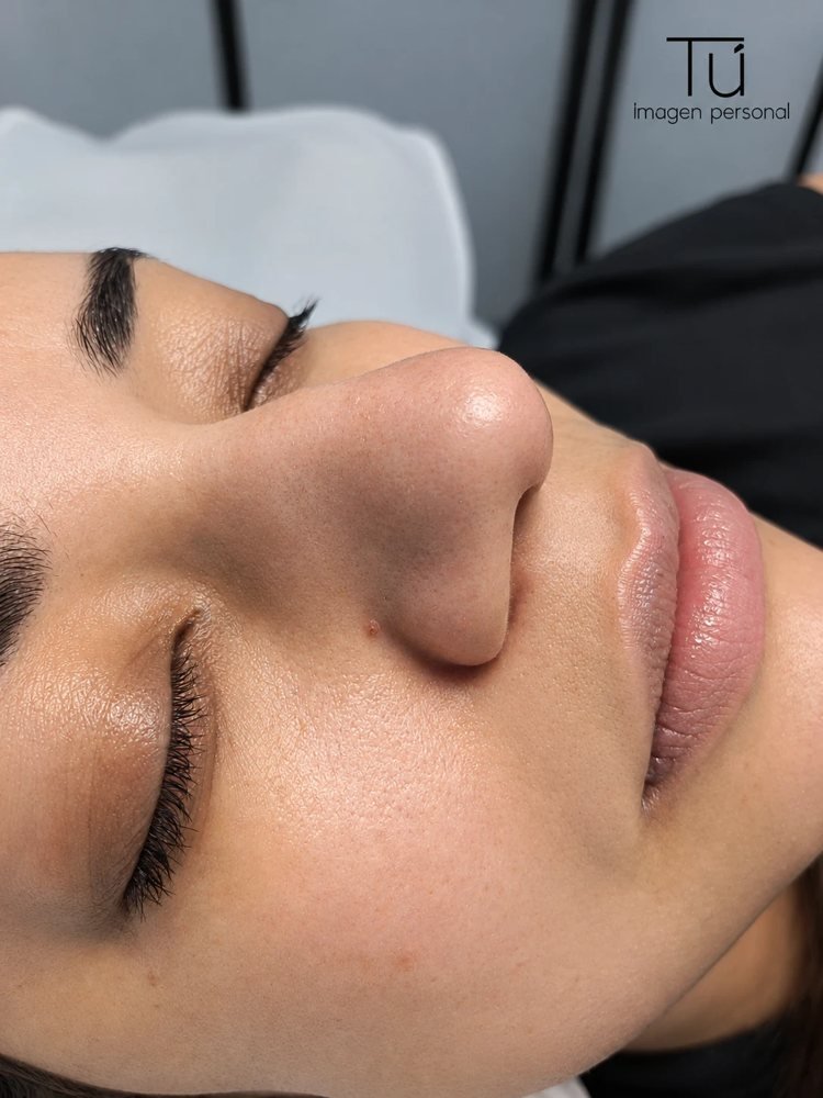 Piel del rostro tras una limpieza facial profunda